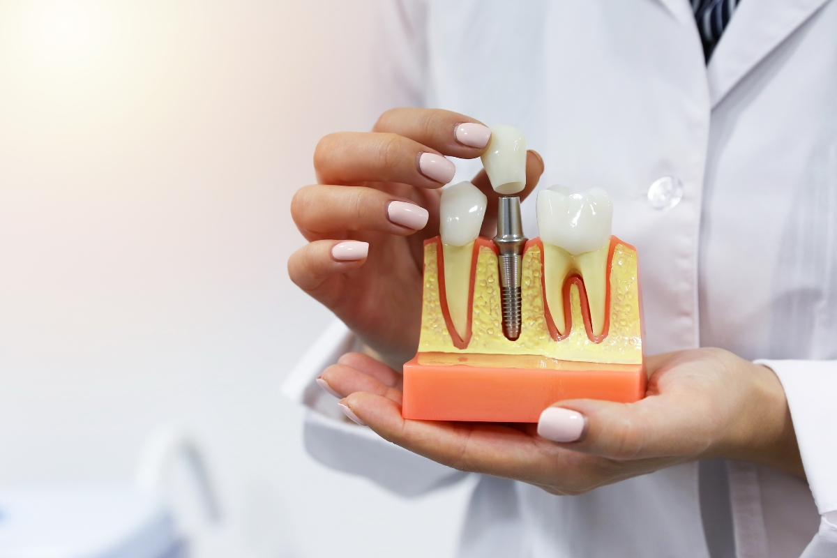 dental implants in Florham Park