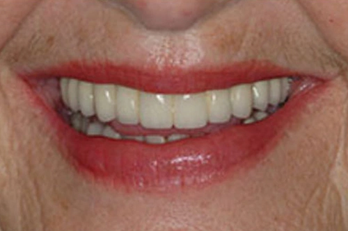 Smile Gallery