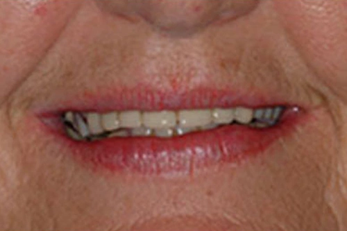 Smile Gallery