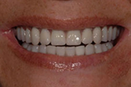 Smile Gallery