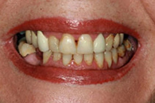 Smile Gallery