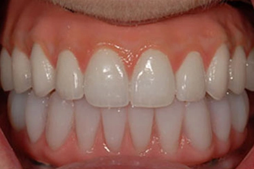 Smile Gallery