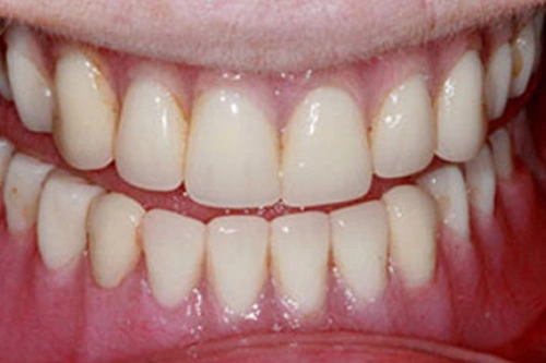 Smile Gallery