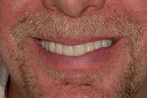 Smile Gallery