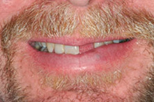 Smile Gallery