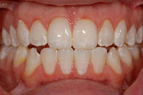 Smile Gallery