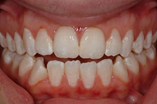 Smile Gallery