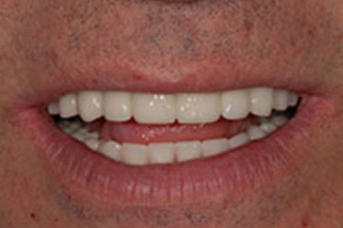 Smile Gallery