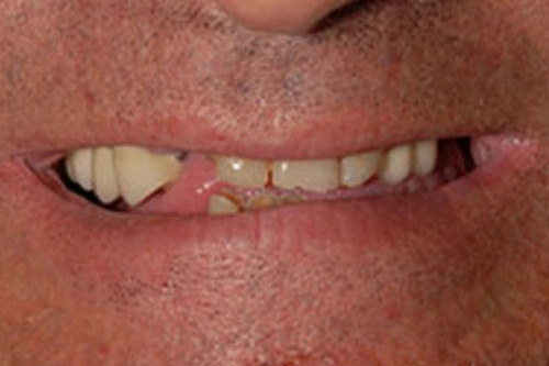 Smile Gallery