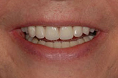 Smile Gallery