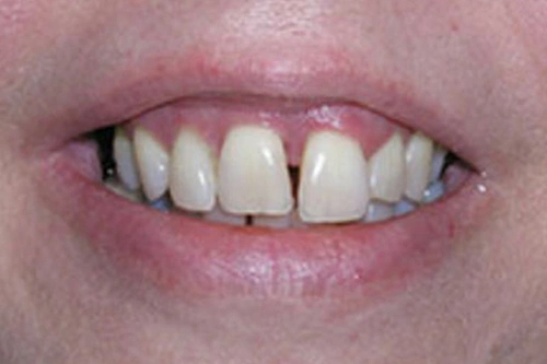 Smile Gallery