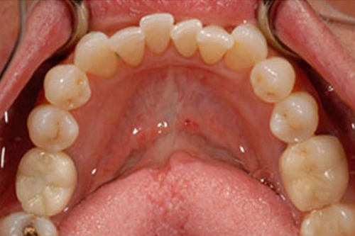 Smile Gallery