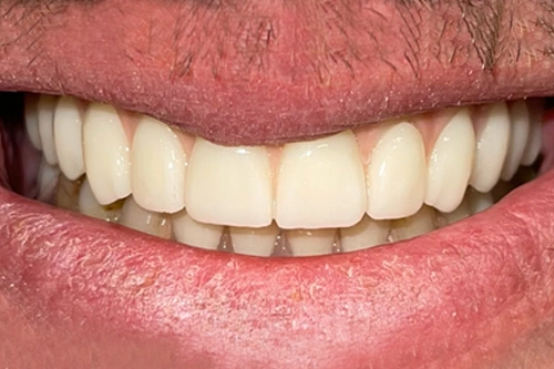 Smile Gallery