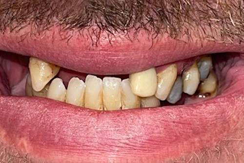 Smile Gallery