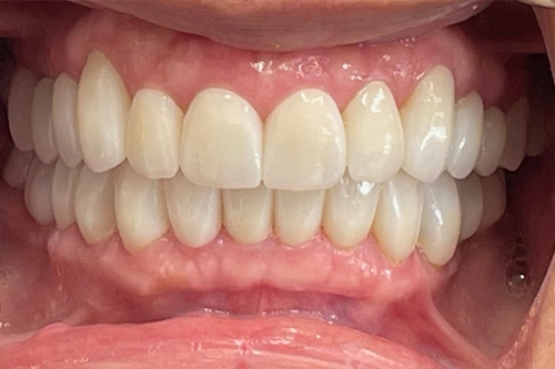 Smile Gallery