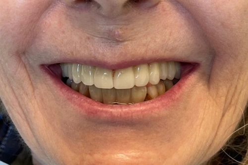Smile Gallery