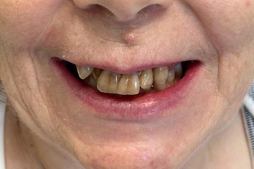 Smile Gallery