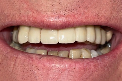 Smile Gallery