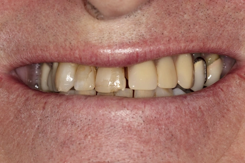 Smile Gallery
