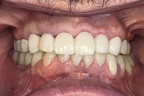 Smile Gallery