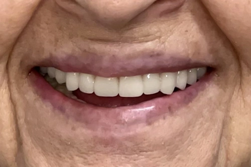 Smile Gallery