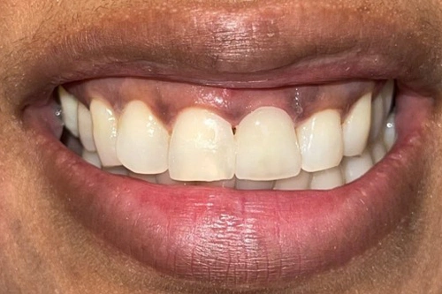 Smile Gallery