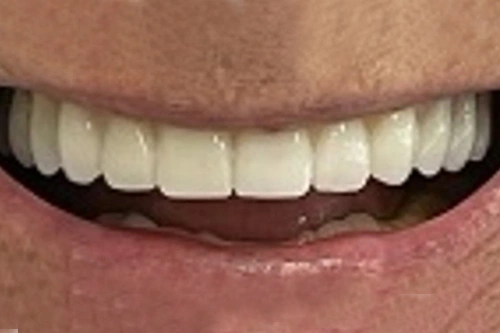 Smile Gallery
