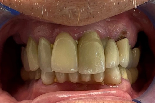 Smile Gallery