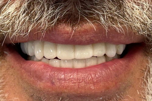 Smile Gallery